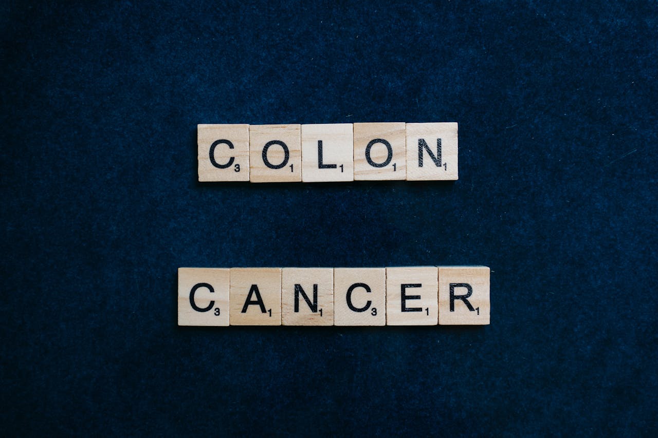 Image of colon cancer