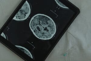 Full body check up scan