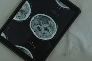 Full body check up scan