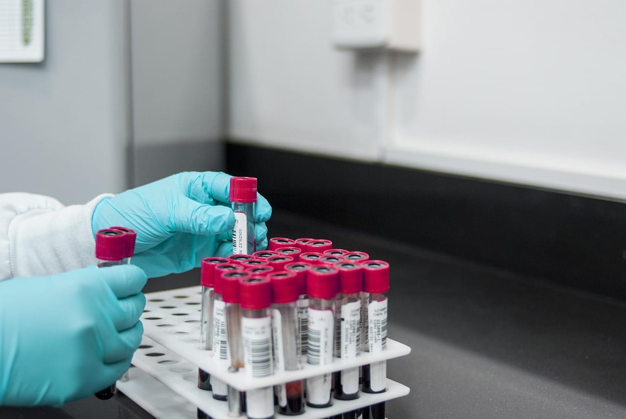 Laboratory technician handling blood sample tubes