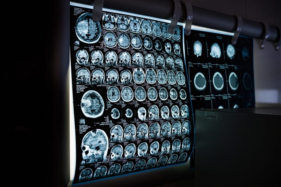 Health scan x-ray report